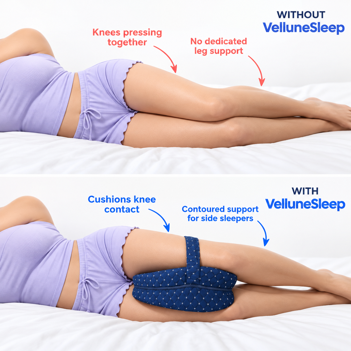 Side sleeping without and with VelluneSleep ComfortAlign knee support